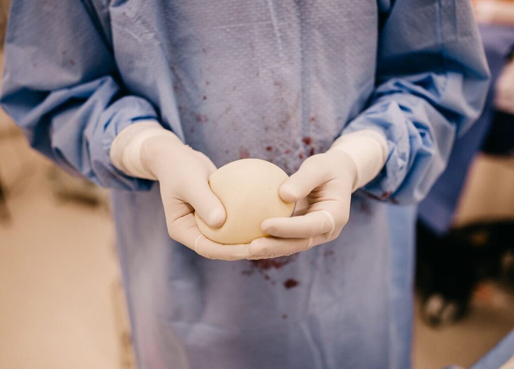 Ameliyat önlüğü ve eldivenle silikon göğüs implantını elinde tutan cerrah